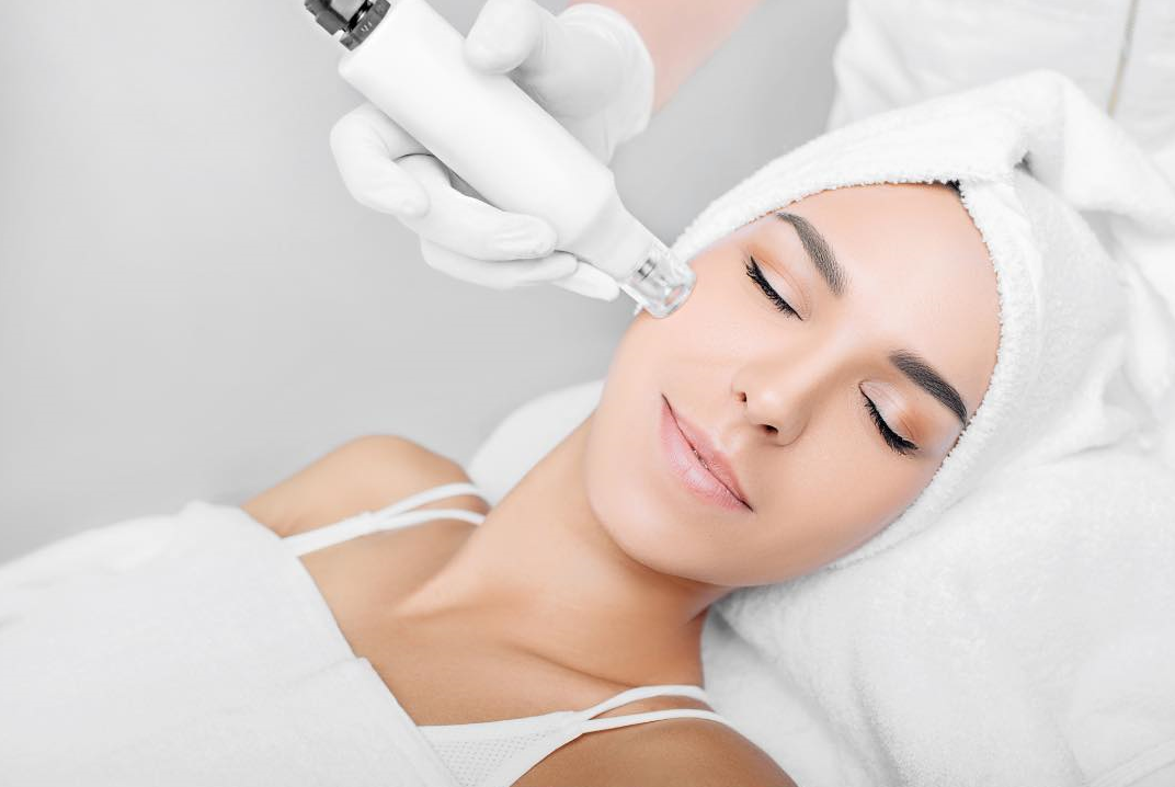 Microneedling hobart