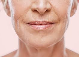 Dermal fillers and anti wrinkle injections can help reduce the appearance of 