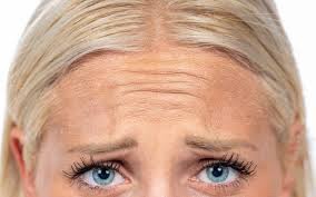 anti-wrinkle injections can treat frown lines, crows feet, forehead lines, headaches, jaw clenching, facial slimming and excessive sweating.