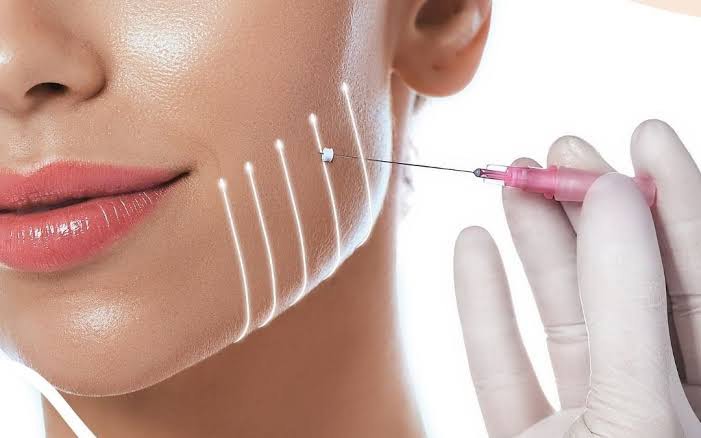 Hobart PDO Thread lifting is a minimally invasive cosmetic enhancement technique that uses surgical suture threads to lift sagging skin on the face and neck.