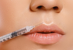 Achieving the Perfect Cupid’s Bow: Everything You Need to Know About Lip Fillers