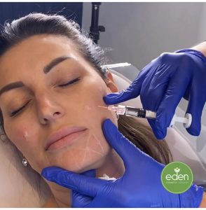 Achieve youthful, radiant eyes with our non-surgical dermal filler treatment tear trough filler