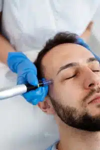Embrace a more youthful and vibrant appearance with micro-needling for men at Eden Cosmetic Therapies in Hobart. Our TGA-approved SkinPen device delivers tailored treatments for all skin types.