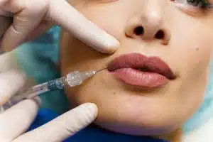 Reveal your perfect pout with customized lip filler treatments at Eden Cosmetic Therapies – Schedule your consultation now.