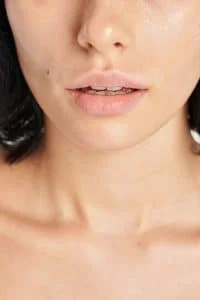 Trust the experienced professionals at Eden Cosmetic Therapies in Hobart for safe and effective lip filler treatments.